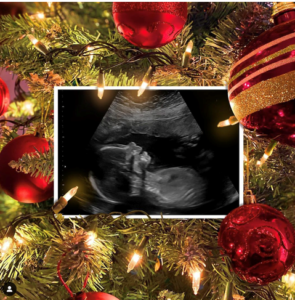 Christmas Pregnancy: Nuts are high in protein and make a great nutritious snack for both you and your kid.